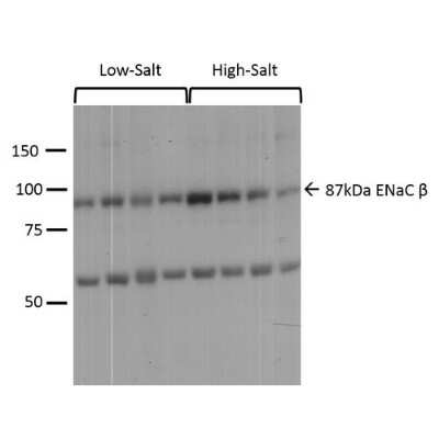 Western Blot: epithelial Sodium Channel beta Antibody [NBP3-18257]